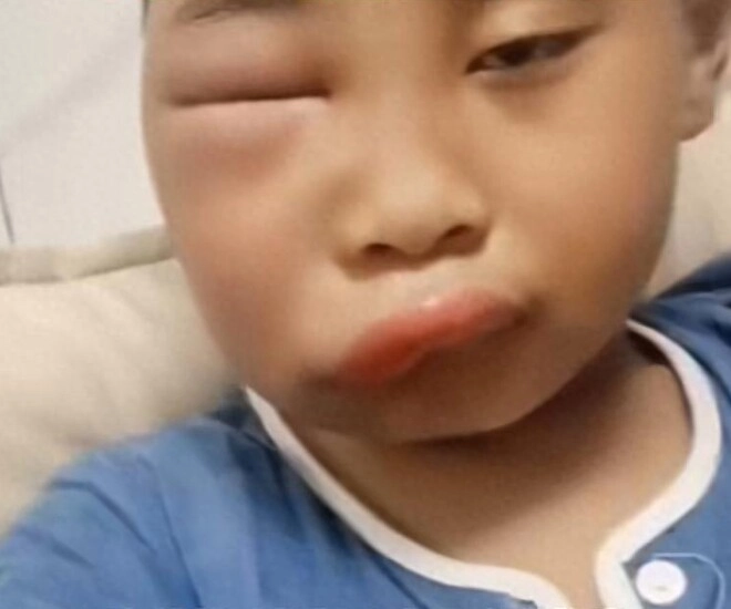 Gửi con về quê nghỉ hè với ông bà ngày về đón mẹ tá hoả khi mặt đứa trẻ biến dạng - 1