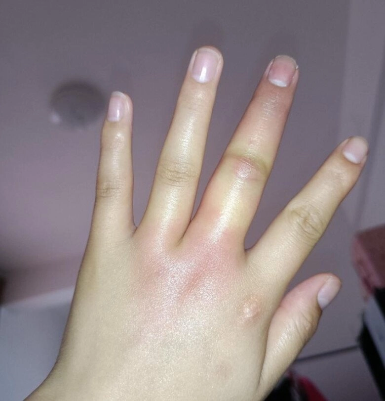 Gửi con về quê nghỉ hè với ông bà ngày về đón mẹ tá hoả khi mặt đứa trẻ biến dạng - 2