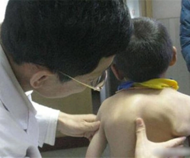 Mẹ phát hiện lưng con ngày càng biến dạng biết nguyên nhân do thói quen của bà nội người mẹ hối hận - 1