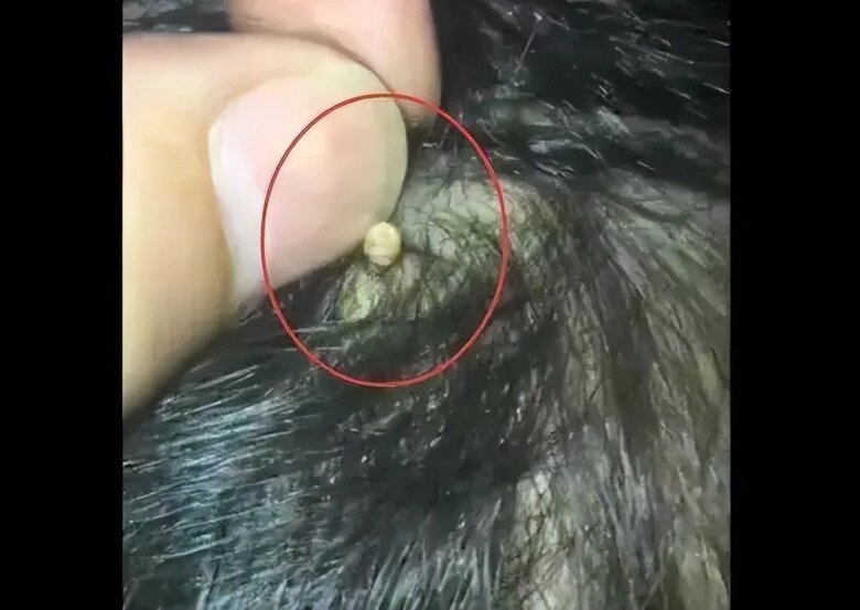 Mẹ phát hiện trên đầu con xuất hiện một lỗ sâu kỳ lạ liền đưa đi khám đến bệnh viện bác sĩ nói đứa trẻ quá may mắn - 2