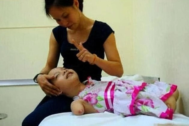 Mẹ quyết sinh con không có taychân dù gia đình nội chối bỏ đứa trẻ càng lớn càng xinh như thiên thần - 2
