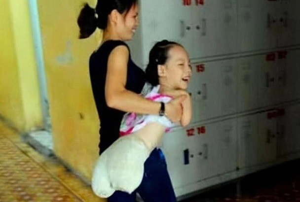 Mẹ quyết sinh con không có taychân dù gia đình nội chối bỏ đứa trẻ càng lớn càng xinh như thiên thần - 4
