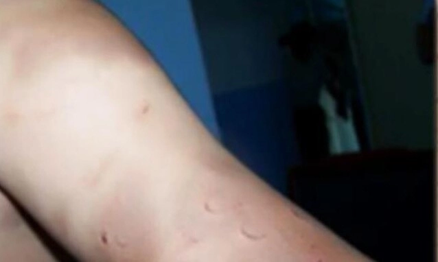 Người mẹ phát hiện con 1 tuổi cứ được anh trai bế là khóc thét lúc kiểm tra cơ thể đứa trẻ mẹ mới tá hoả - 2
