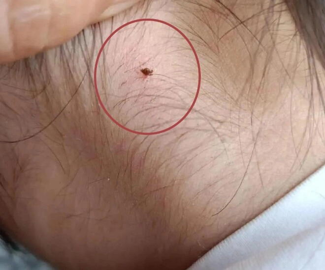 Phát hiện sinh vật lạ cắn vào cổ con gái 4 tuổi người mẹ vẫn từ chối hai lần cứu con và cái kết không ngờ - 1