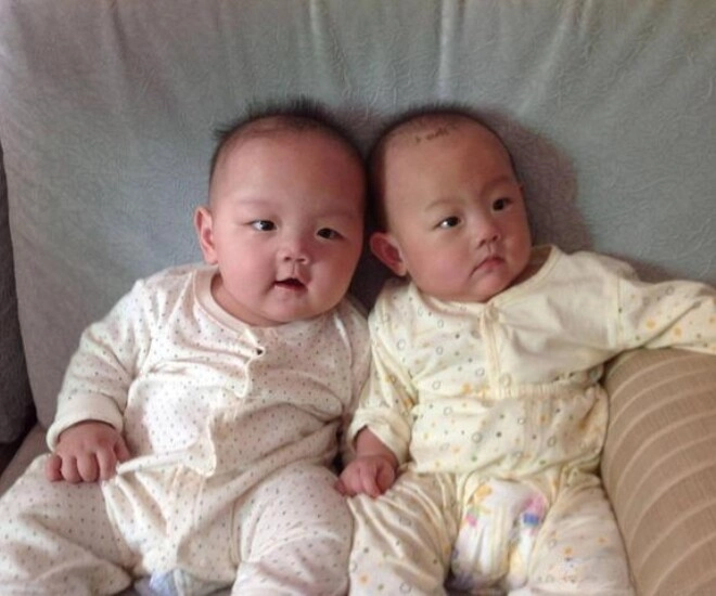 Sinh đôi nhưng diện mạo khác nhau một bé da đen một bé da trắng chồng lén vợ xét nghiệm adn kết quả khó tin - 1