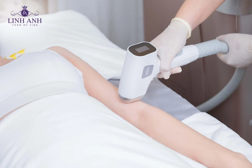 Triệt lông tại thẩm mỹ viện linh anh nơi khởi đầu cho làn da sạch sáng mịn - 1