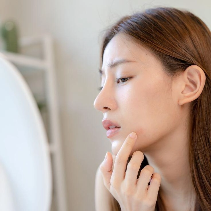 3 thực phẩm vào ngày tết càng dễ khiến lão hóa sớm chị em lưu ý để không mất vẻ ngoài rạng rỡ đầu năm - 3