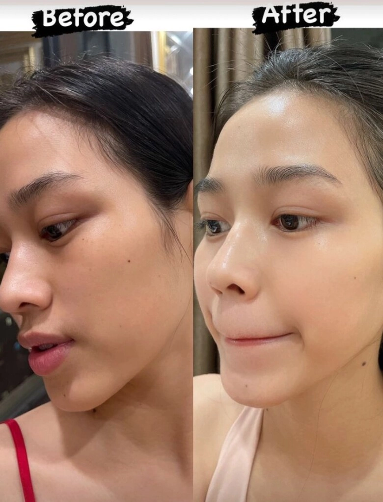 4 loại thực phẩm là máy bơm siêu dưỡng chất càng ăn càng trẻ hóa làn da được nhiều sao việt tin dùng - 2