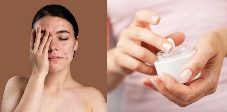 7 điều cấm kỵ khi chăm sóc da trước ngày cưới nếu không muốn da xỉn màu nổi mụn - 5