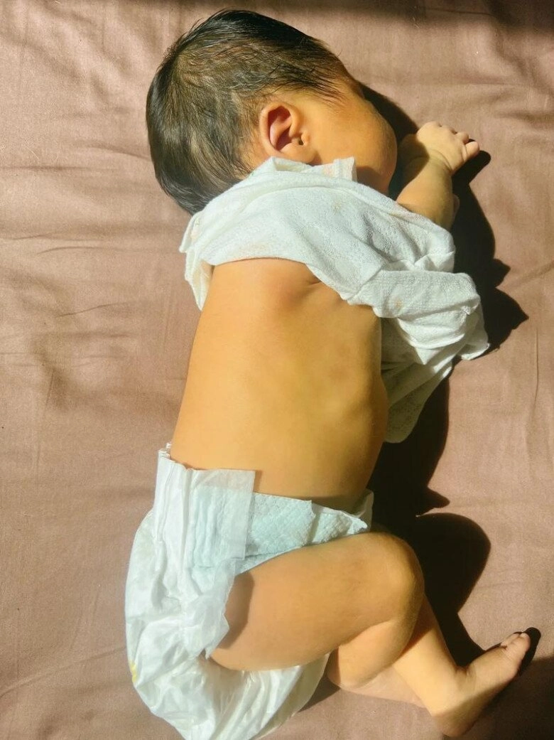 Bác sĩ đề nghị điều trị vàng da cho cháu sơ sinh nhưng bà nội kiên quyết từ chối 1 tháng sau cả gia đình suy sụp - 2