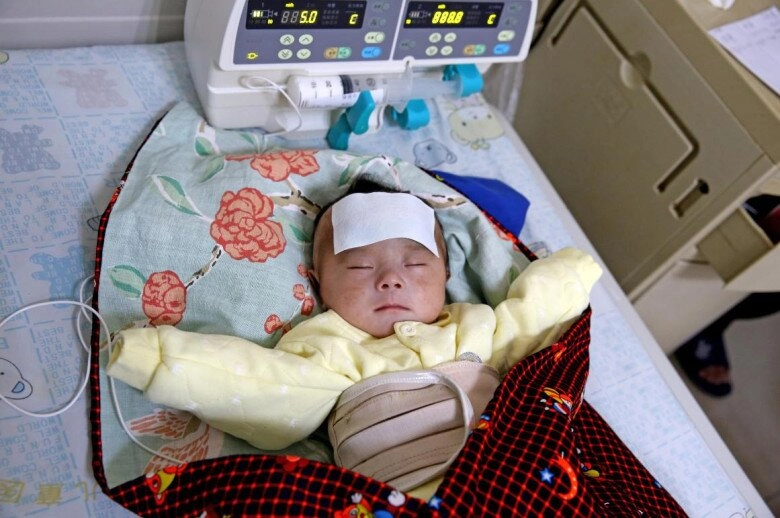 Bé 7 tháng tuổi bị liệt nửa người mẹ suy sụp khi nghe bác sĩ nói nguyên nhân do thói quen của bà nội - 2
