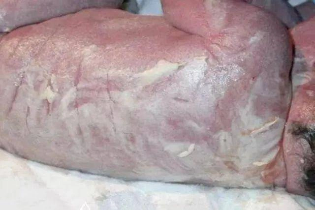 Bố mẹ phát hoảng khi con sơ sinh chào đời người trắng bệch tưởng bệnh lạ nhưng bác sĩ lại vỗ tay chúc mừng - 2