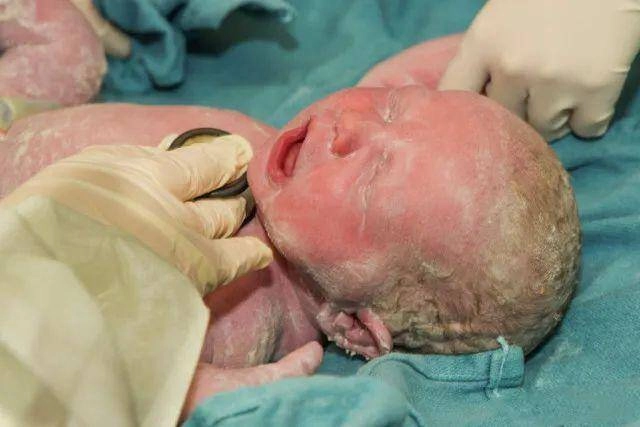 Bố mẹ phát hoảng khi con sơ sinh chào đời người trắng bệch tưởng bệnh lạ nhưng bác sĩ lại vỗ tay chúc mừng - 3