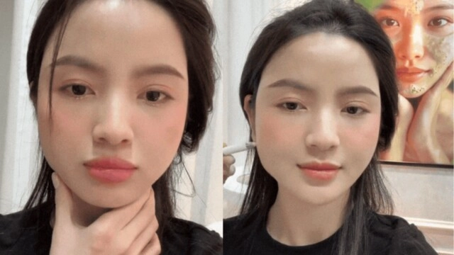 Các nàng wags nô nức thẩm mỹ làm đẹp cận tết bà xã đoàn văn hậu thừa nhận liều lĩnh vì một điều - 6