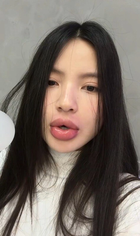 Các nàng wags nô nức thẩm mỹ làm đẹp cận tết bà xã đoàn văn hậu thừa nhận liều lĩnh vì một điều - 7