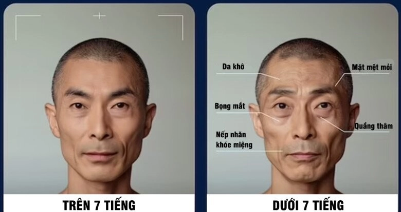 Chỉ ngủ 6 tiếng mỗi ngày diện mạo của bạn sẽ thay đổi thế nào nhìn hậu quả này chị em hết dám thức khuya - 3