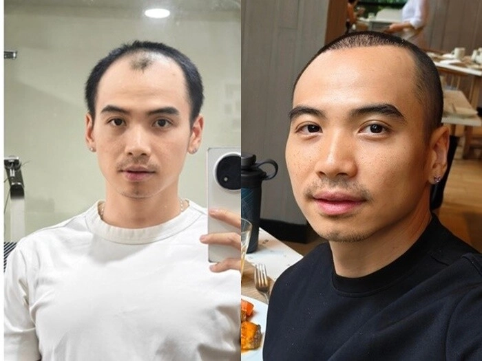 Chồng hhen niê đầu óc trống rỗng khi vắng vợ được nàng hậu kèm cặp mỗi tối nhưng vẫn run rẩy khi gặp nhiều người - 9