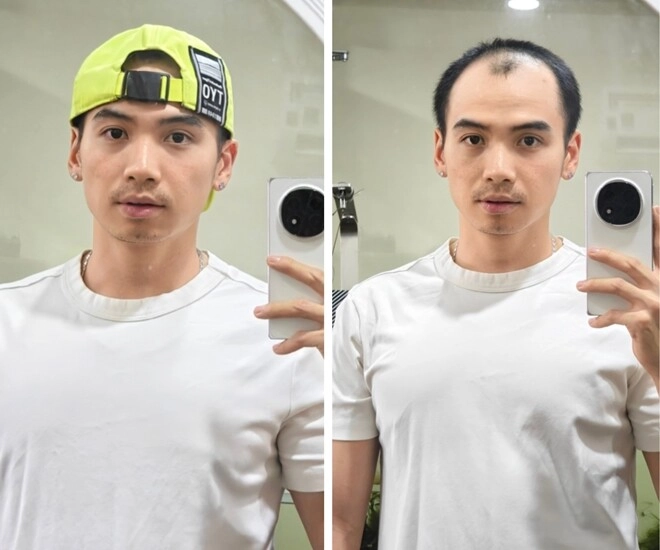 Chồng hhen niê đi đâu cũng được hỏi đã mọc tóc chưa hiện nổi tiếng hơn cả vợ hoa hậu - 6