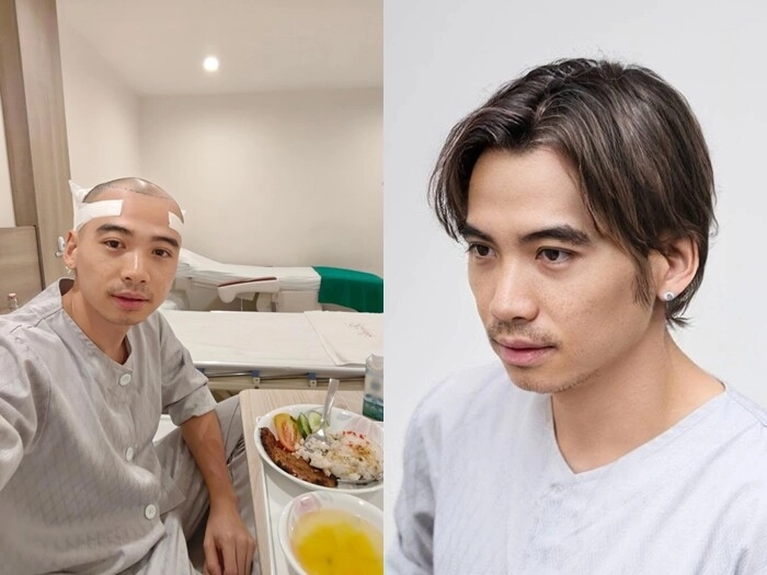 Chồng hhen niê đi đâu cũng được hỏi đã mọc tóc chưa hiện nổi tiếng hơn cả vợ hoa hậu - 7