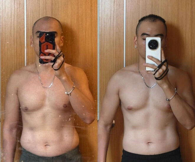 Chồng hhen niê nỗ lực thay đổi ngoại hình từ khi cưới vợ hoa hậu hết phẫu thuật cấy tóc đến nhờ ai giúp giảm cân - 1
