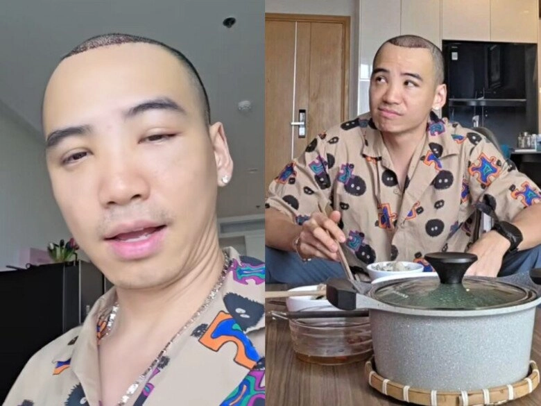 Chồng hhen niê nỗ lực thay đổi ngoại hình từ khi cưới vợ hoa hậu hết phẫu thuật cấy tóc đến nhờ ai giúp giảm cân - 8