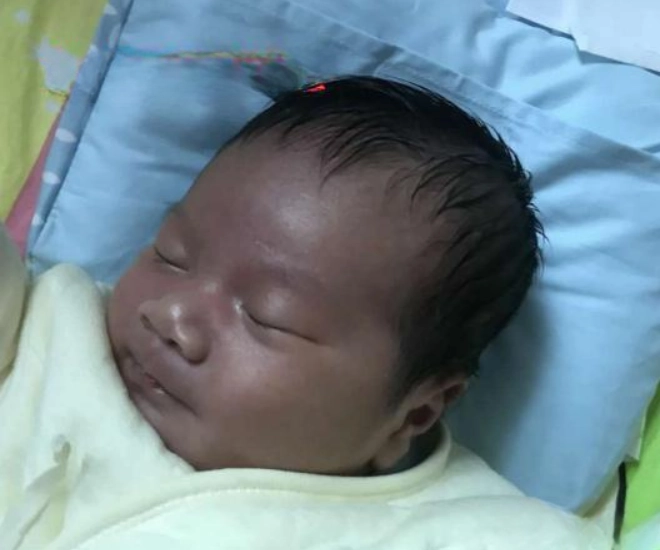 Con sơ sinh chào đời làn da lúc đen xì lúc tím tái bố mẹ sợ hãi không dám bế và cái kết sau 1 tháng - 1