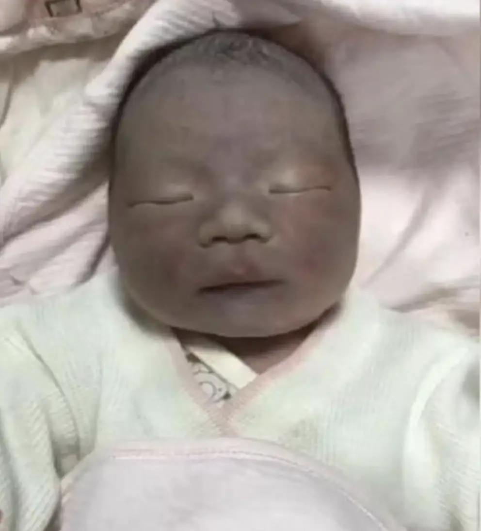 Con sơ sinh chào đời làn da lúc đen xì lúc tím tái bố mẹ sợ hãi không dám bế và cái kết sau 1 tháng - 2
