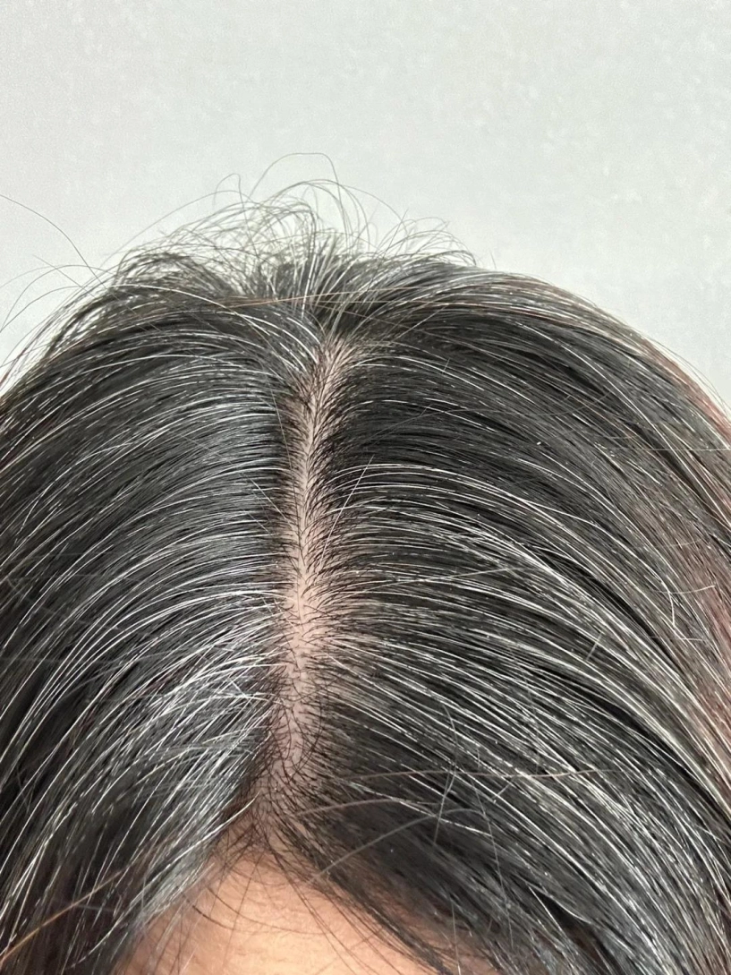 Còn trẻ nhưng tóc đã bạc chuyên gia tiết lộ 5 bước đảo ngược tình trạng lão hóa sớm của màu tóc - 2