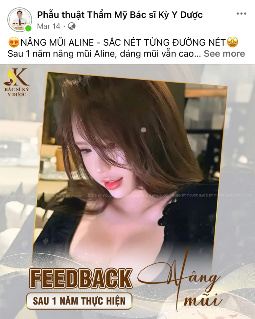 Dáng mũi aline chuẩn từng milimet từ bác sĩ kỳ y dược - 5
