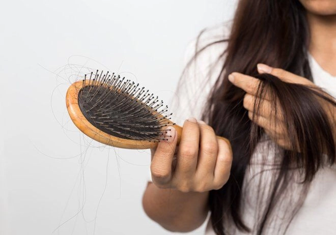 Để tránh tóc rụng triền miên chị em nên dừng ngay thói quen tai hại này - 4