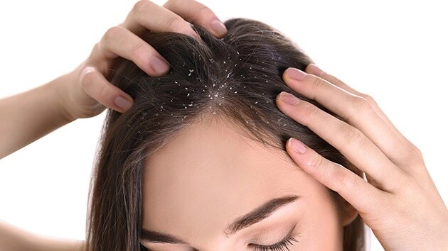 Để tránh tóc rụng triền miên chị em nên dừng ngay thói quen tai hại này - 5