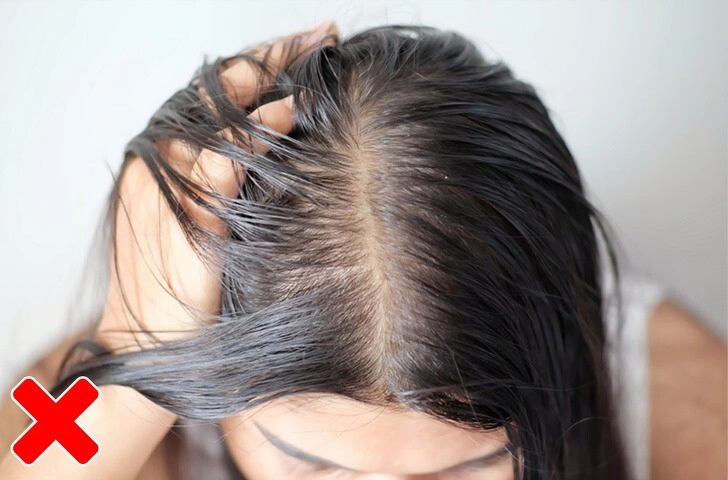 Dùng dầu gội trị gàu mà tóc vẫn như tuyết rơi mùa hè có lẽ bạn đã sai ngay từ bước đầu tiên - 7