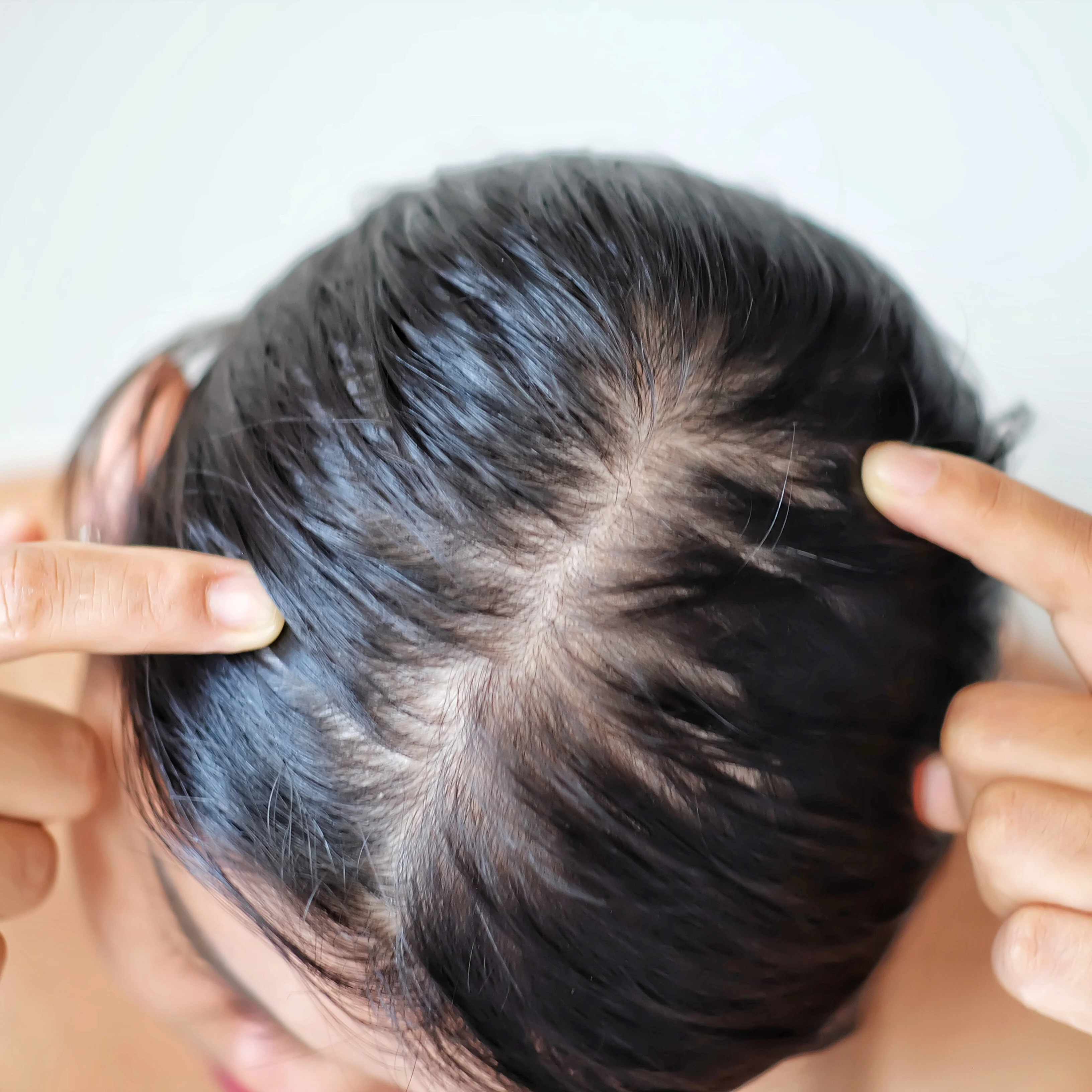 Dùng dầu xả ủ tóc trong bao lâu là hợp lý tóc dầu hoặc mỏng phải biết điều này để tóc không bết dính - 4