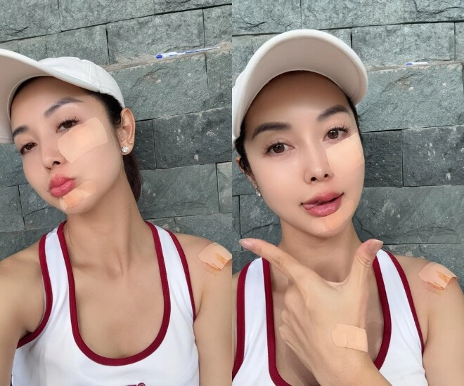 Hoa hậu jennifer phạm trầy hết nửa mặt vì ngã khi chơi pickleball dân mạng bày tỏ không phải chồng mà nhìn còn xót - 1