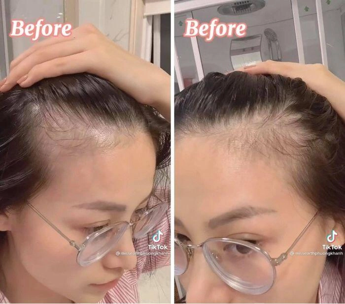 Hoa hậu phương khánh thoát khỏi ám ảnh tóc rụng nhờ loại thảo dược chị em từ đông sang tây rần rần tìm kiếm - 3