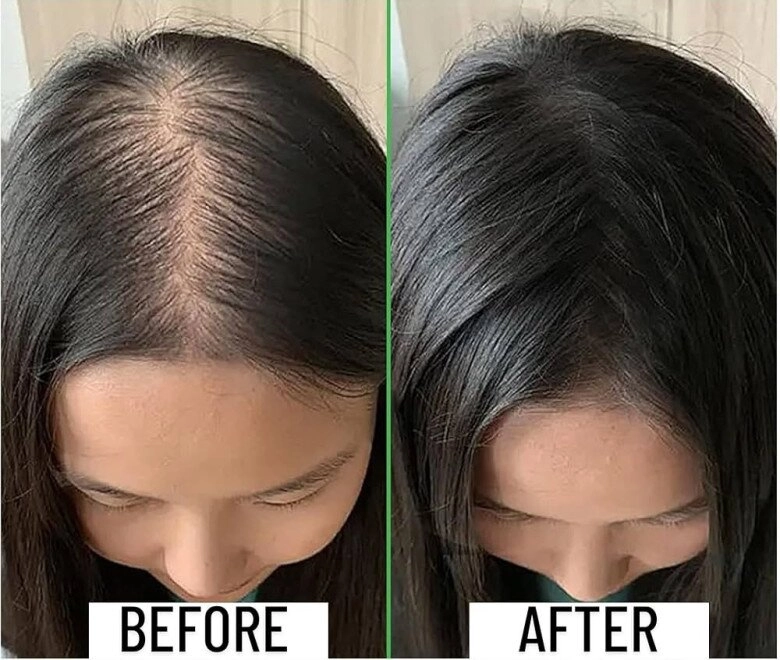 Hoa hậu phương khánh thoát khỏi ám ảnh tóc rụng nhờ loại thảo dược chị em từ đông sang tây rần rần tìm kiếm - 7