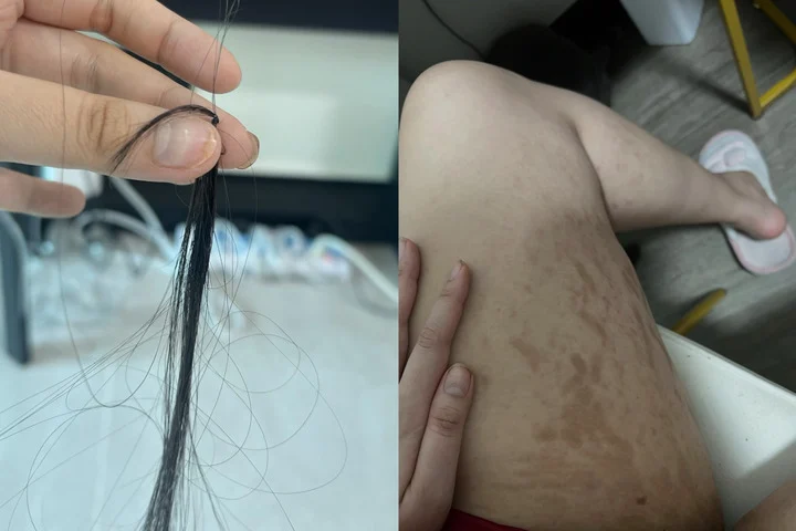 Hội mỹ nhân vạn người mê khi rơi vào trầm cảm người tăng cân không nhận ra người cạo trọc đầu - 8