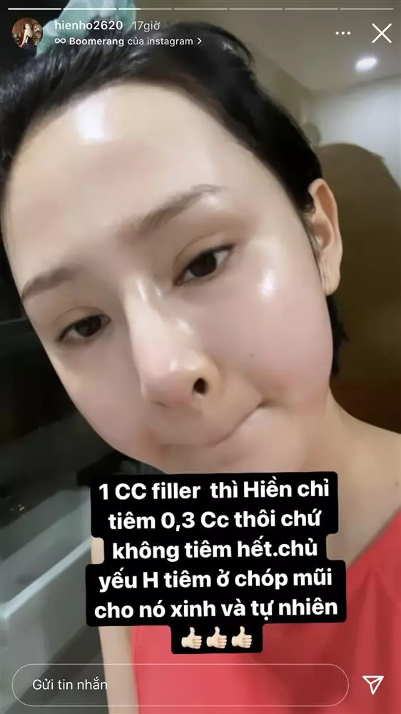 Khi các nữ ca sĩ việt bị dính tin đồn đập đi xây lại người thẳng thừng đáp trả người áp lực dần rời showbiz - 13
