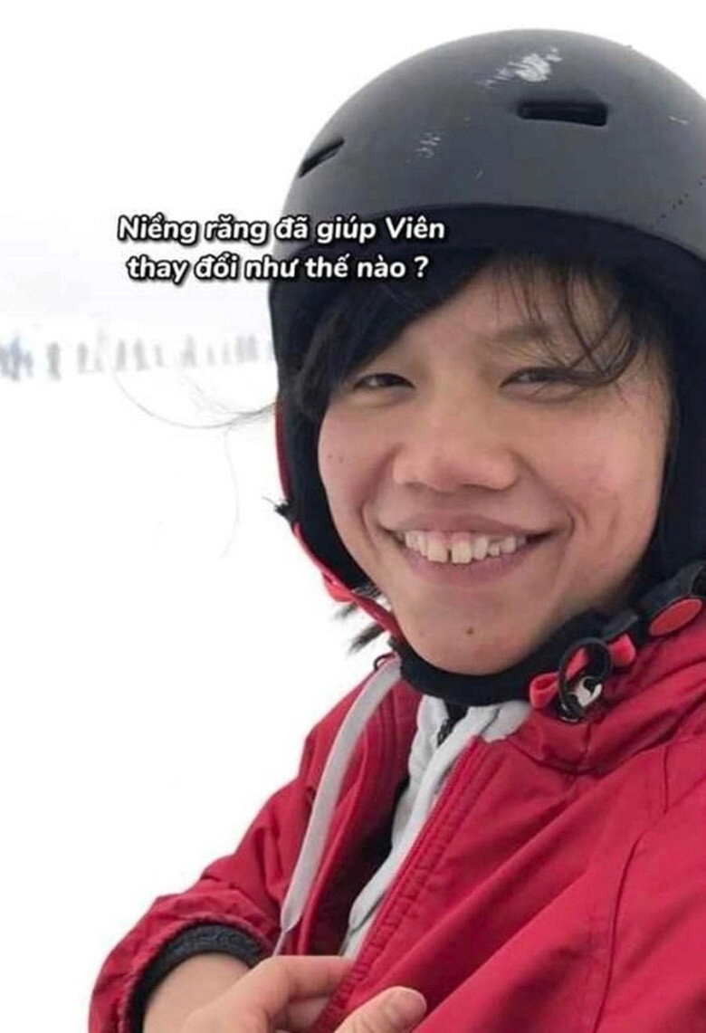 kình ngư ánh viên chia sẻ quá khứ kém xinh với tóc ngắn da sạm khó tin giờ là hot girl xinh đẹp - 7