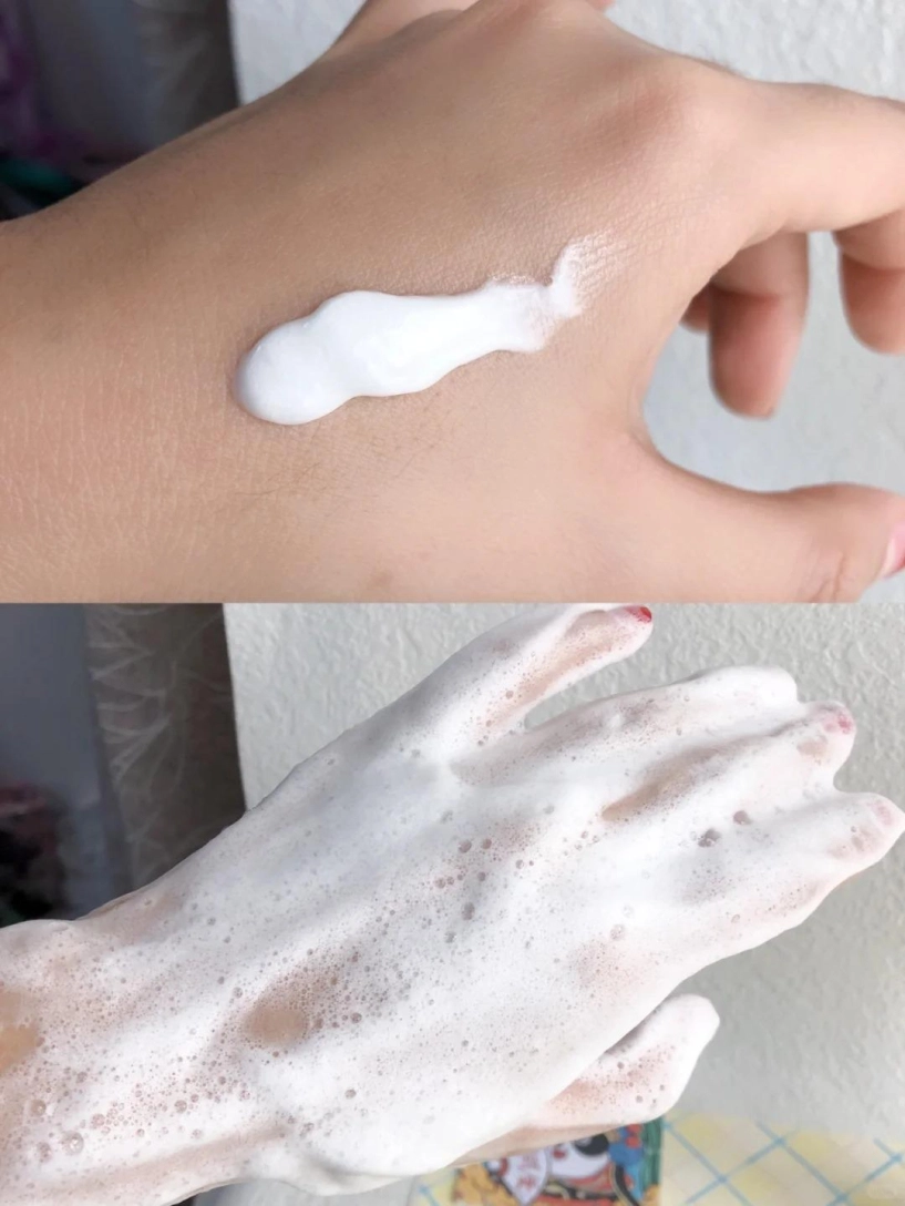 Làm sạch da kỹ lưỡng nhưng vẫn mụn đầu đen vẫn xuất hiện có phải vì dùng sai loại sữa rửa mặt - 3