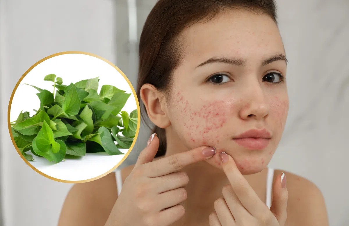 Loại rau giá rẻ bèo ngoài chợ là thần dược cho hội chị em 5 công dụng đỉnh từ trị mụn giảm cân đến điều hòa nội tiết tố - 1