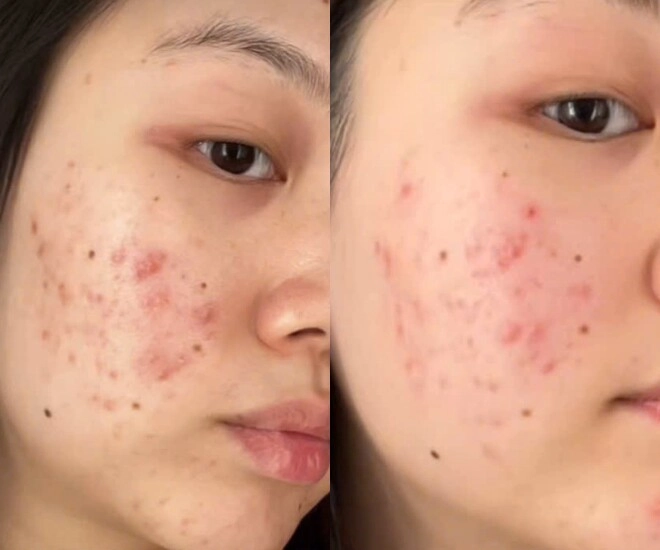 Món ăn được đồn giúp da sáng mịn có gì khiến chị em tranh cãi người khen ngon người chê không nuốt nổi - 4
