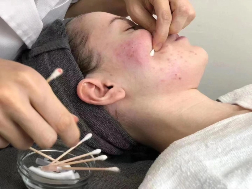 Nếu sở hữu làn da nâu chị em tốt nhất đừng nên thử các công thức làm đẹp này - 2