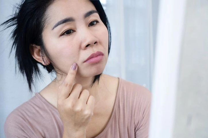 Ngủ tư thế này khiến nếp nhăn ngày càng sâu chuyên gia chỉ cách ngủ đúng để da căng mịn trẻ lâu - 1