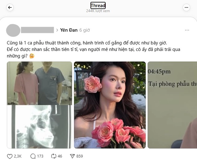 Nhan sắc nàng thơ mới của soobin sau màn phẫu thuật thẩm mỹ đại thành công hiện tại - trước kia như hai người khác - 4