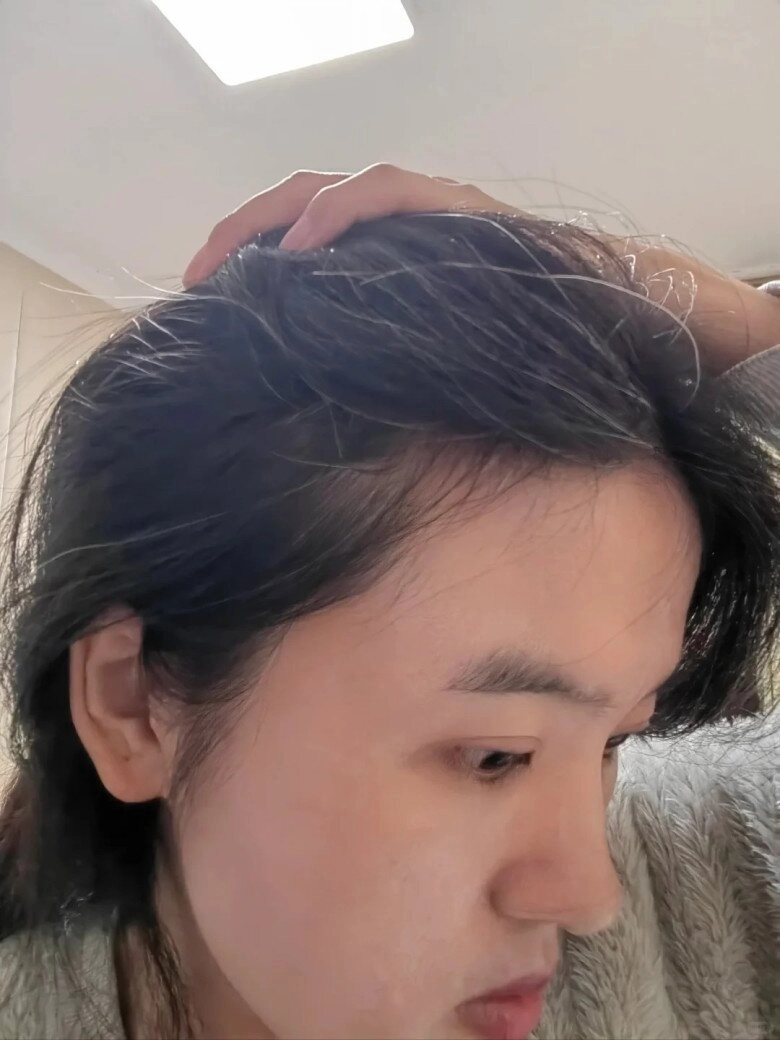 Nhổ tóc không làm giảm đi lượng tóc bạc chị em áp dụng 4 mẹo sau để tóc đen nhánh và bóng khỏe - 1
