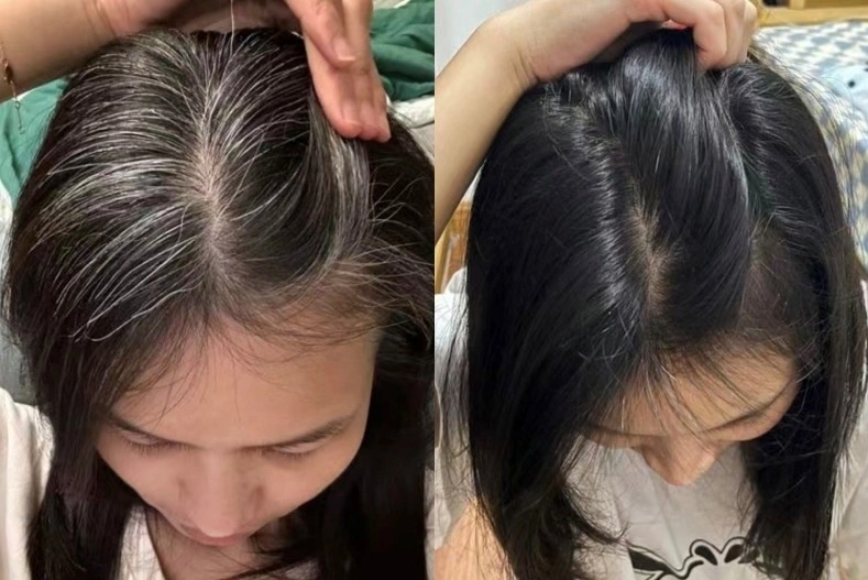 Nhổ tóc không làm giảm đi lượng tóc bạc chị em áp dụng 5 mẹo sau để tóc đen nhánh và óng mượt như lụa - 5