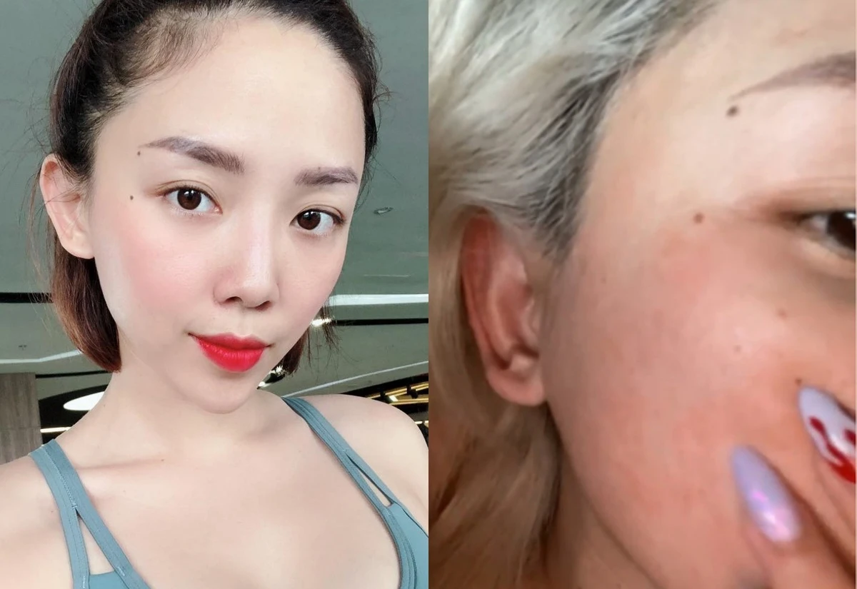 Những thành phần dưỡng da gặp trời nắng liền phản chủ càng dùng càng làm da bị kích ứng nặng - 3