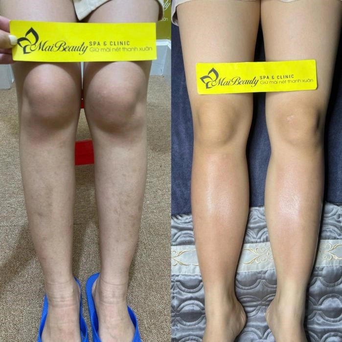 Phòng khám chuyên khoa da liễu mai beauty địa chỉ chăm sóc da chuyên nghiệp chuẩn y khoa - 2