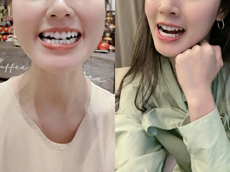 Phương nhi và midu dẫu đẹp tự nhiên vẫn phải chỉnh sửa 1 điểm để hoá phượng hoàng gia nhập vũ trụ hào môn - 8